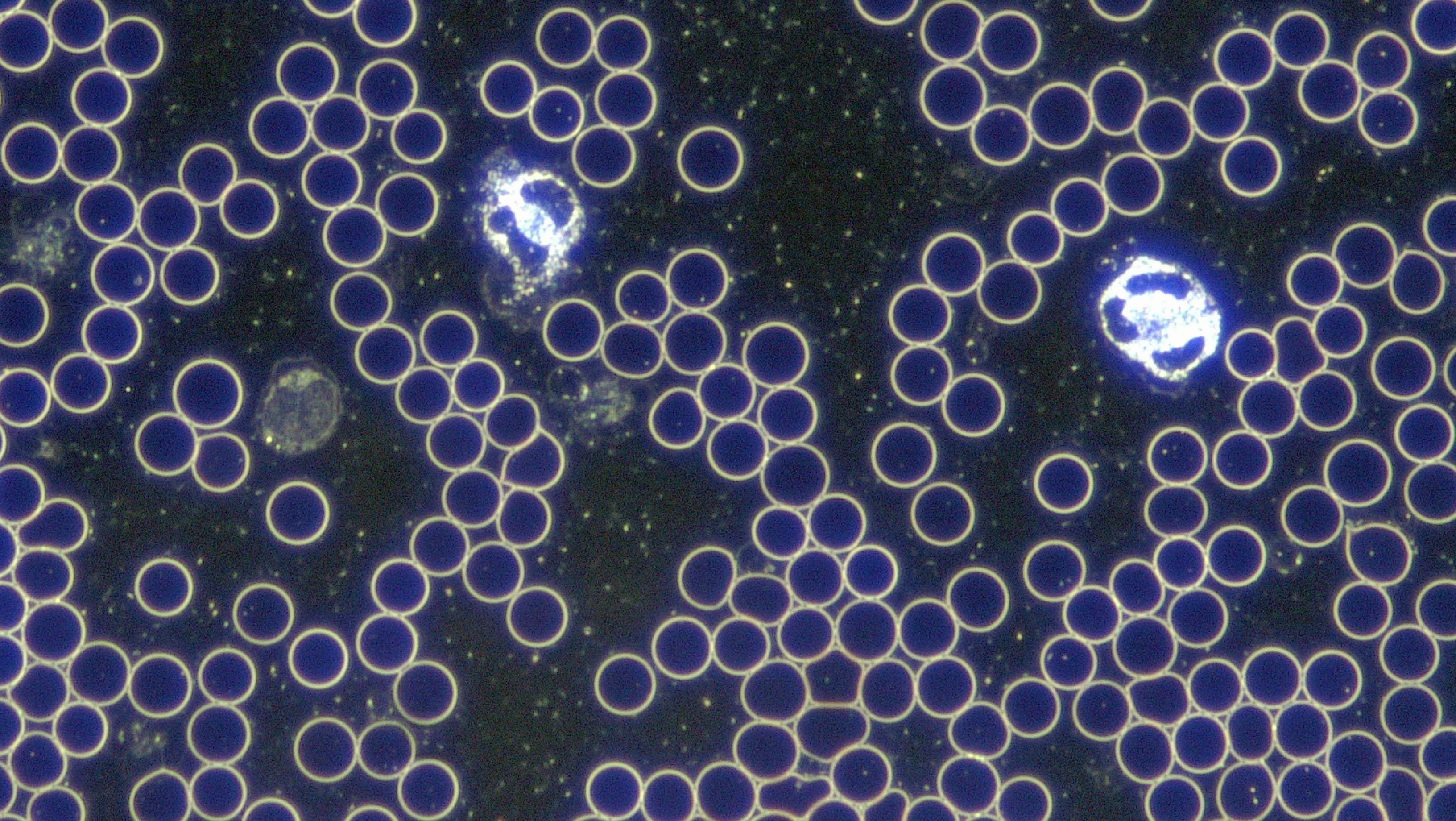Поле микроскопа. Dark field microscopy. Микроскопия. Спеклы микроскопия. Много пузырей микроскоп.